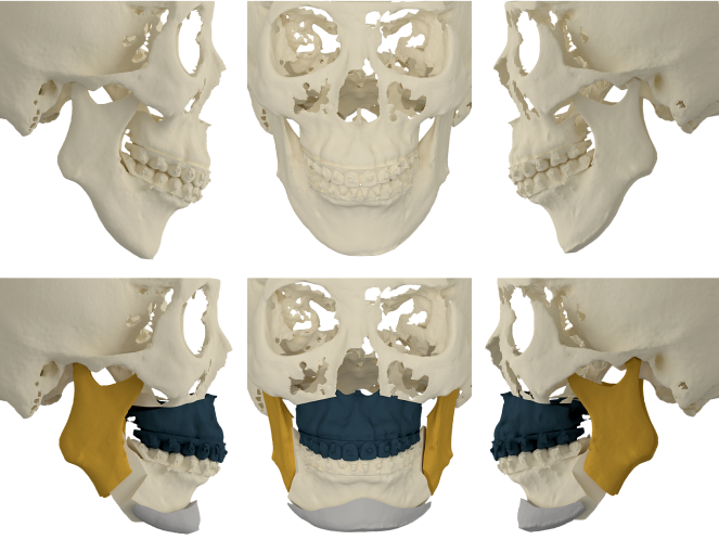 Galeria – 3D Surgery